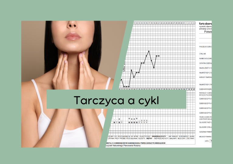 Read more about the article Zaburzenia hormonalne cz. 3 – tarczyca
